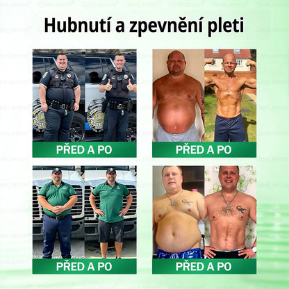 Oficiální prodejna BENU | 🎁 𝐆𝐞𝑒𝑙𝑒𝐦𝐨𝐧® Glum𝐚𝐬𝐞tide 8 v 1 – Zeštíhlující nano mikrojihlový náplast 🇨🇿 Jen 1× denně ✅ Viditelné změny za 7 dní – na obezitu, kardiovaskulární zdraví, diabetes a kloubní problémy